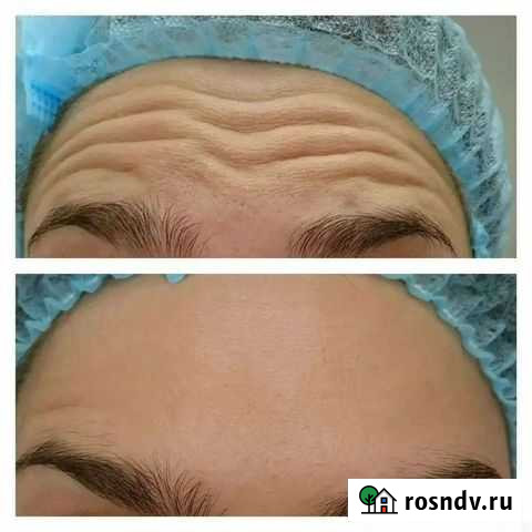 Эстетические процедуры Белгород - изображение 1