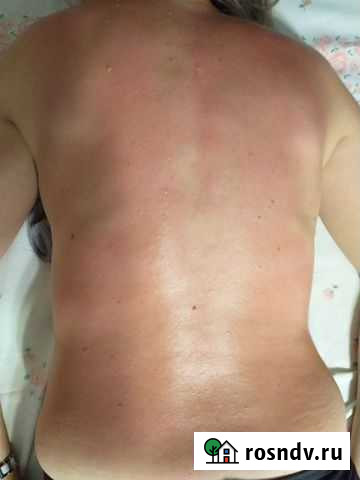 Массаж Волгоград - изображение 1