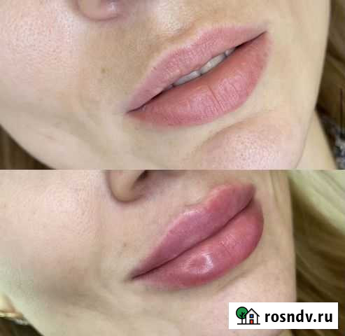 Косметолог Махачкала - изображение 1