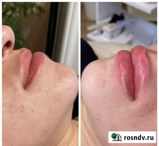 Услуги косметолога Воронеж - изображение 1