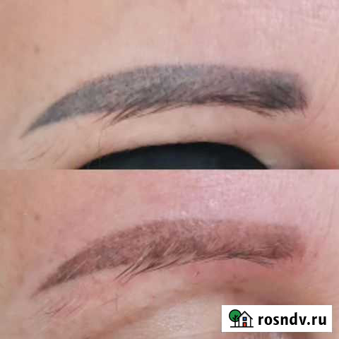 Удаление татуажа лазером Бийск - изображение 1