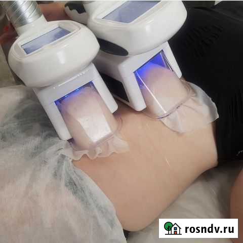 Аппаратный массаж, криолиполиз Москва - изображение 1