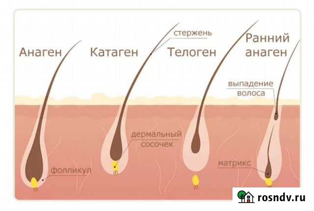 Электроэпиляция Сатка - изображение 1