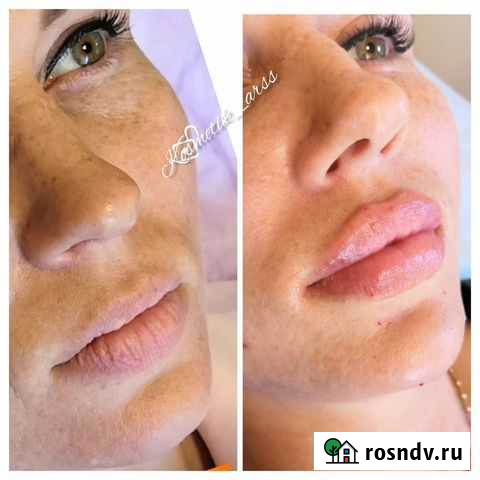 Косметология Новороссийск - изображение 1