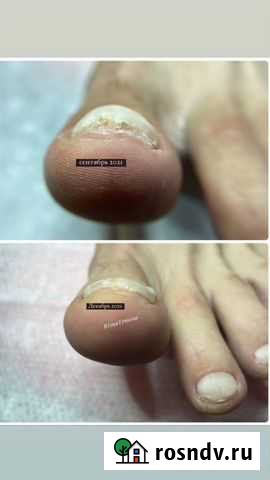 Титановая нить Тамбов - изображение 1