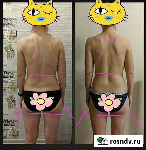 Массаж на дому Ижевск - изображение 1