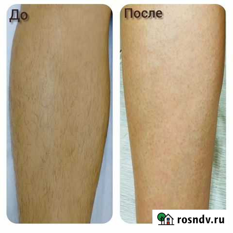 Красота и здоровье Киров - изображение 1