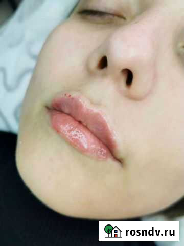 Услуги косметолога Волгоград - изображение 1