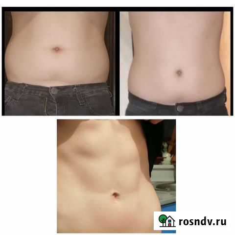 Массаж Новокузнецк - изображение 1