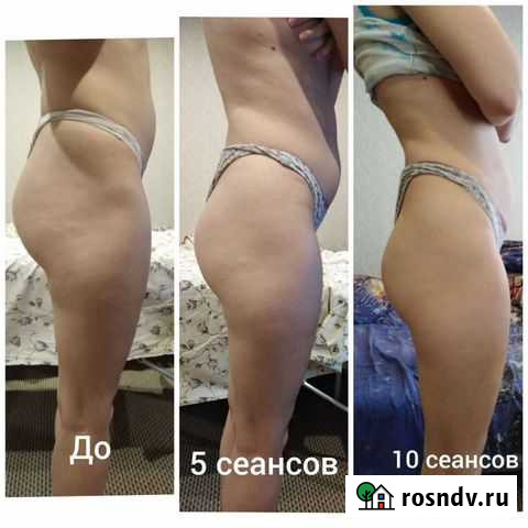 Аппаратный массаж/коррекция фигуры Нижний Новгород - изображение 1