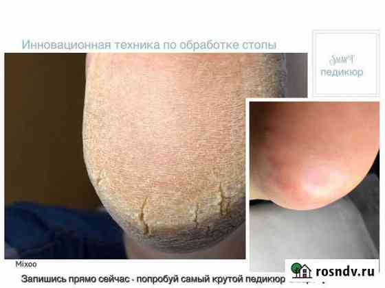 Мастер педикюра, smart педикюр, курсы Пермь