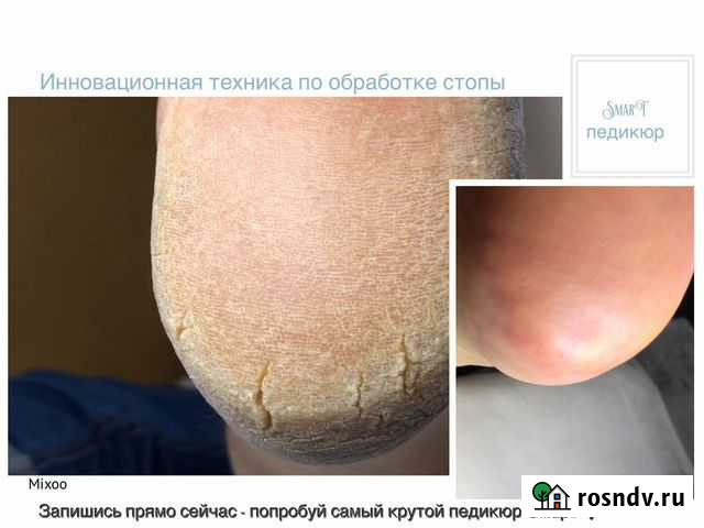 Мастер педикюра, smart педикюр, курсы Пермь - изображение 1