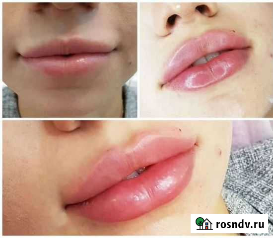 Косметолог, широкий спектр услуг, anti-age процеду Липецк - изображение 1