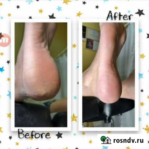 Педикюр Псков Псков - изображение 1