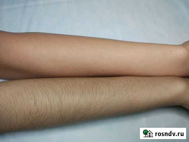 Шугаринг Нижний Тагил - изображение 1