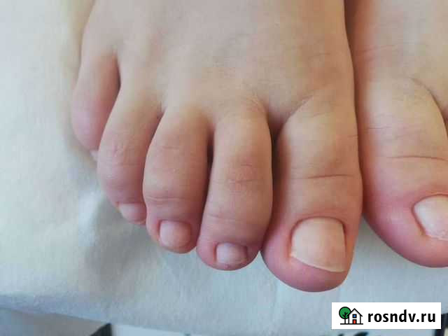 Педикюр Хабаровск - изображение 1