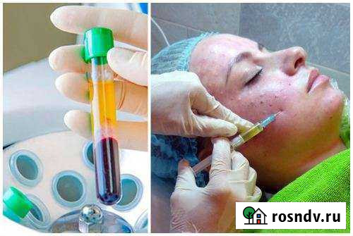 Плазмолифтинг Белгород - изображение 1