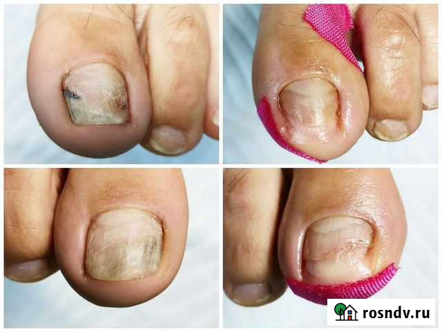 Маникюр/Педикюр/Подолог Брянск - изображение 1