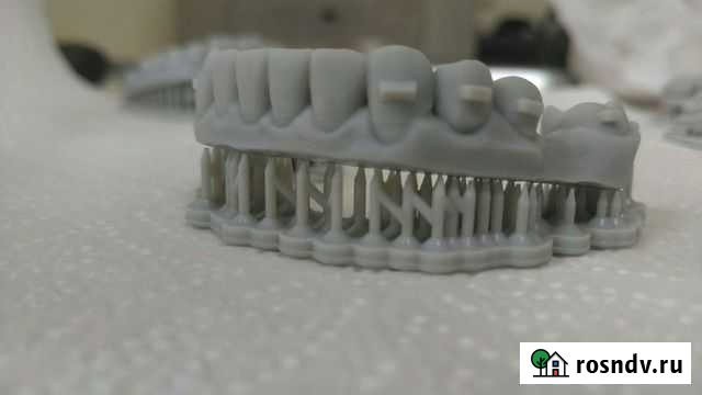 3д печать зубов Москва - изображение 1