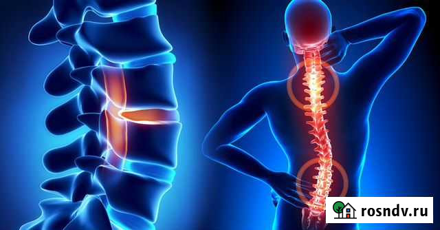 Костоправ, мануальный терапевт Краснодар - изображение 1