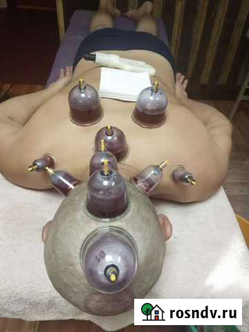Массаж хиджама Москва - изображение 1