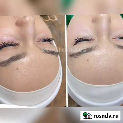 Врач косметолог Грозный Грозный - изображение 1