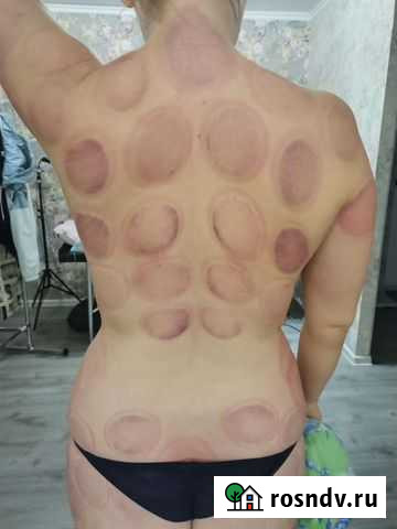 Массаж оздоровительных техник Альметьевск - изображение 1