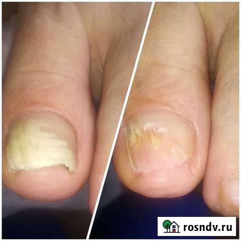 Педикюр Лесосибирск - изображение 1