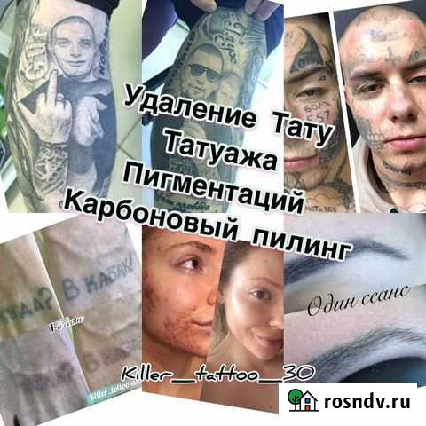 Удаление тату и татуажа Nd-YAG Q-Swich Lazer-ом. К Астрахань - изображение 1