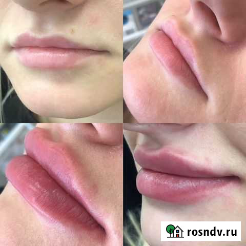 Косметолог чистка лица Краснодар - изображение 1