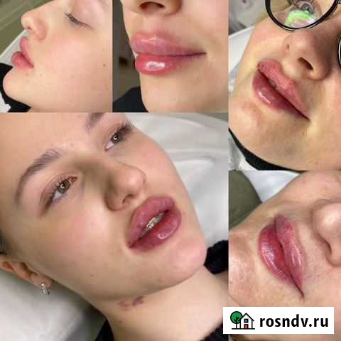 Модель для косметолога Москва - изображение 1