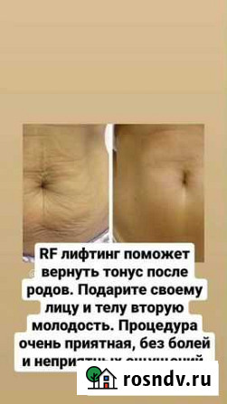 Массаж Нижнекамск - изображение 1