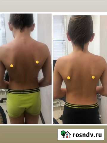 Массаж Нижний Новгород - изображение 1