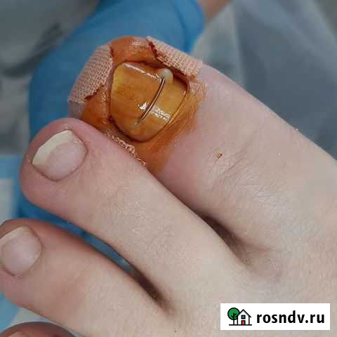 Подолог Стерлитамак - изображение 1