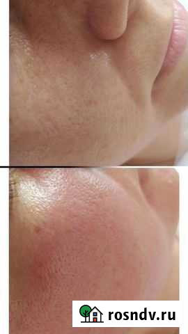 Услуги косметолога Шахты - изображение 1