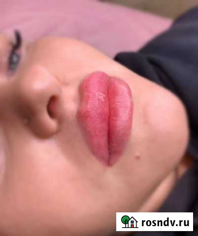 Губы Лесной - изображение 1