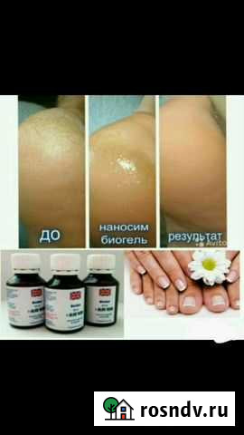 Биогель Ойсхара - изображение 1