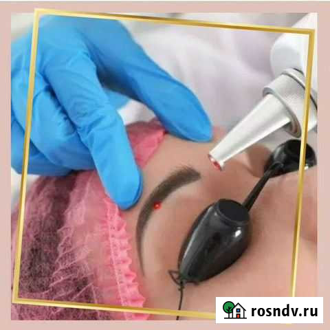 Удаление татуажа и татуировок Оренбург - изображение 1