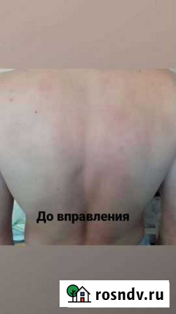 Услуги Костоправа Ставрополь - изображение 1