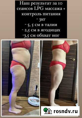 Lpg массаж Петропавловск-Камчатский - изображение 1