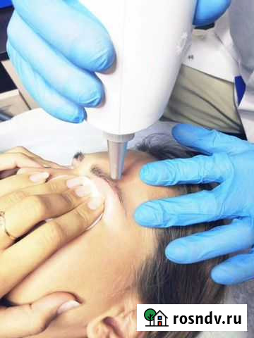 Удаление татуажа и татуировок Махачкала - изображение 1