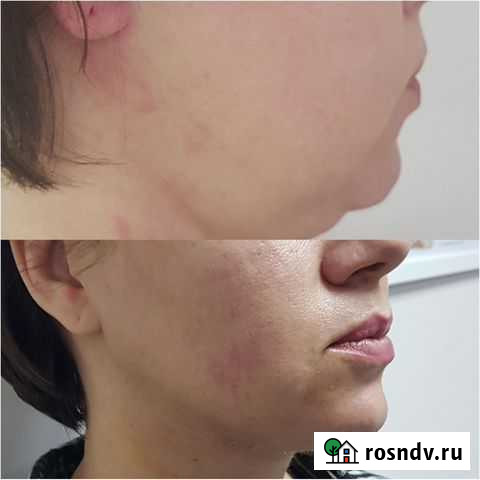 Косметологические услуги Тверь - изображение 1