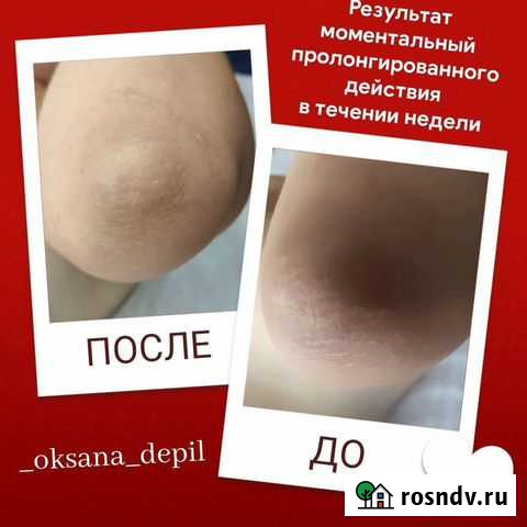 Интимное отбеливание Энгельс - изображение 1