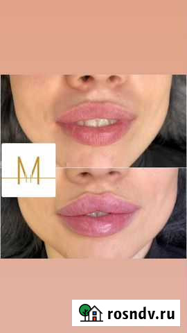 Косметология модели Москва - изображение 1