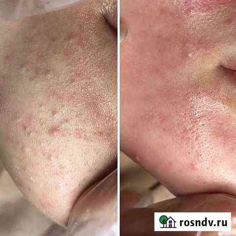Услуги косметолога Таганрог