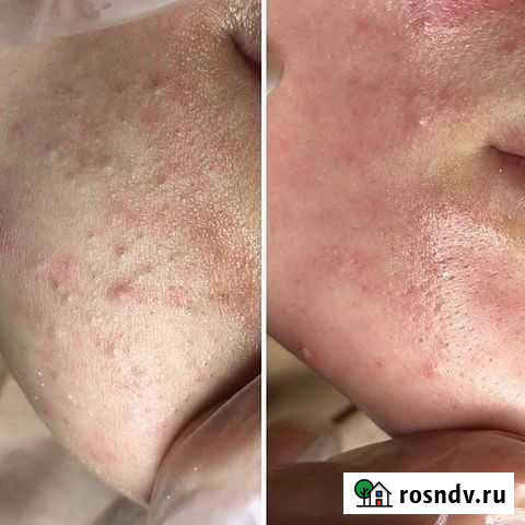 Услуги косметолога Таганрог - изображение 1