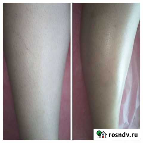 Шугаринг Карпинск - изображение 1