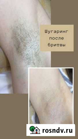Шугаринг мужской, женский и подростковый Буздяк - изображение 1