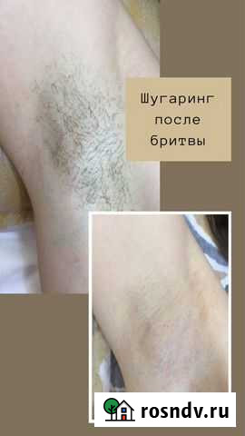 Шугаринг мужской, женский и подростковый Буздяк - изображение 1