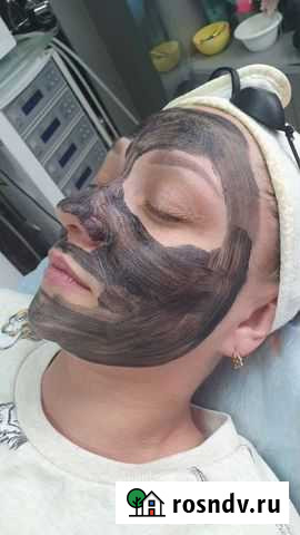 Карбоновый пилинг Оренбург - изображение 1